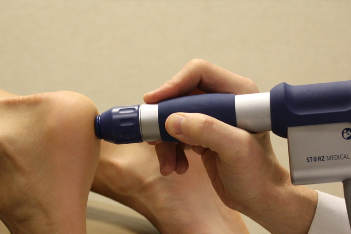 پروتکل بالینی شاک ویو برای درمان خار پاشنه پا