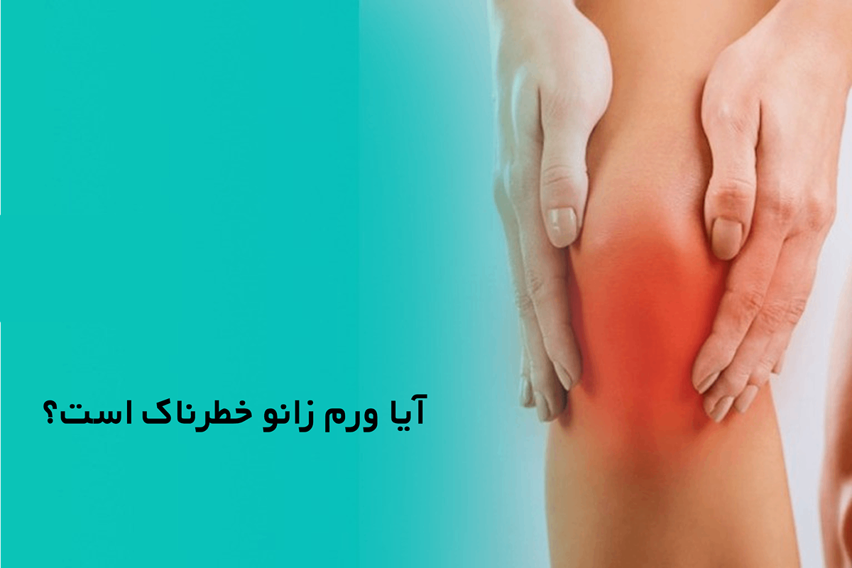 آیا ورم زانو خطرناک است؟