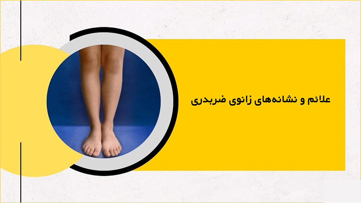 نشانه‌های زانوی ضربدری