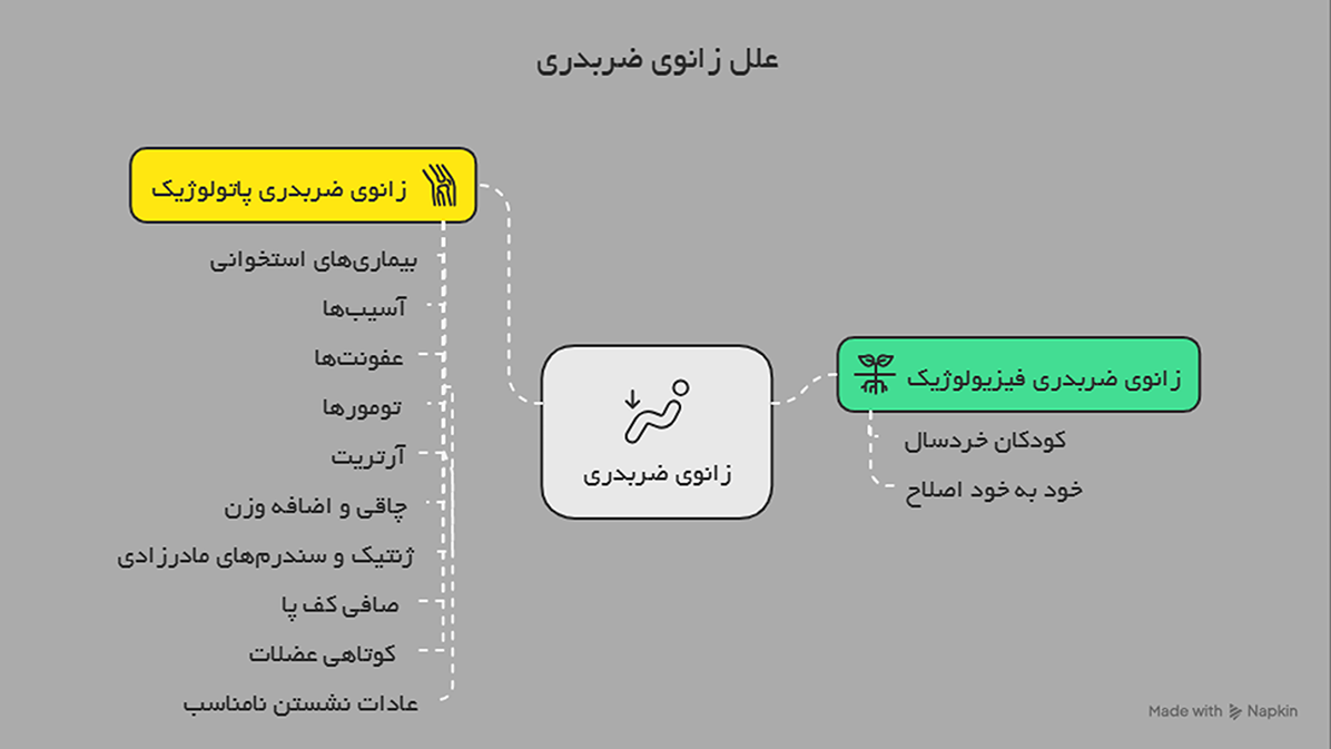 علل زانوی ضربدری