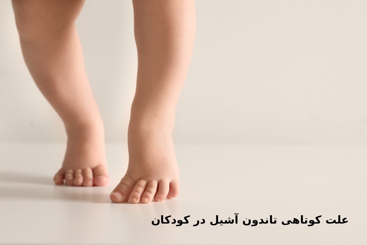 علت کوتاهی تاندون آشیل در کودکان