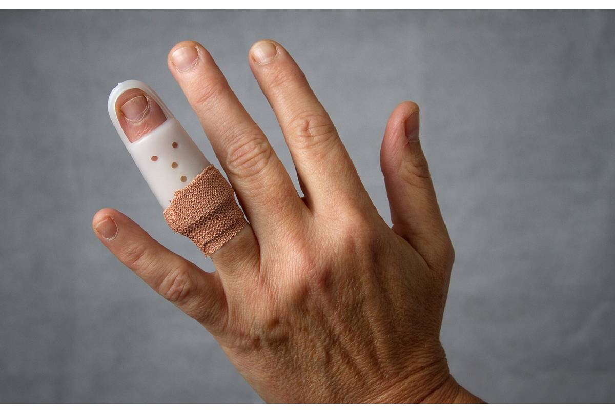 آنل برای شکستگی انگشت دست