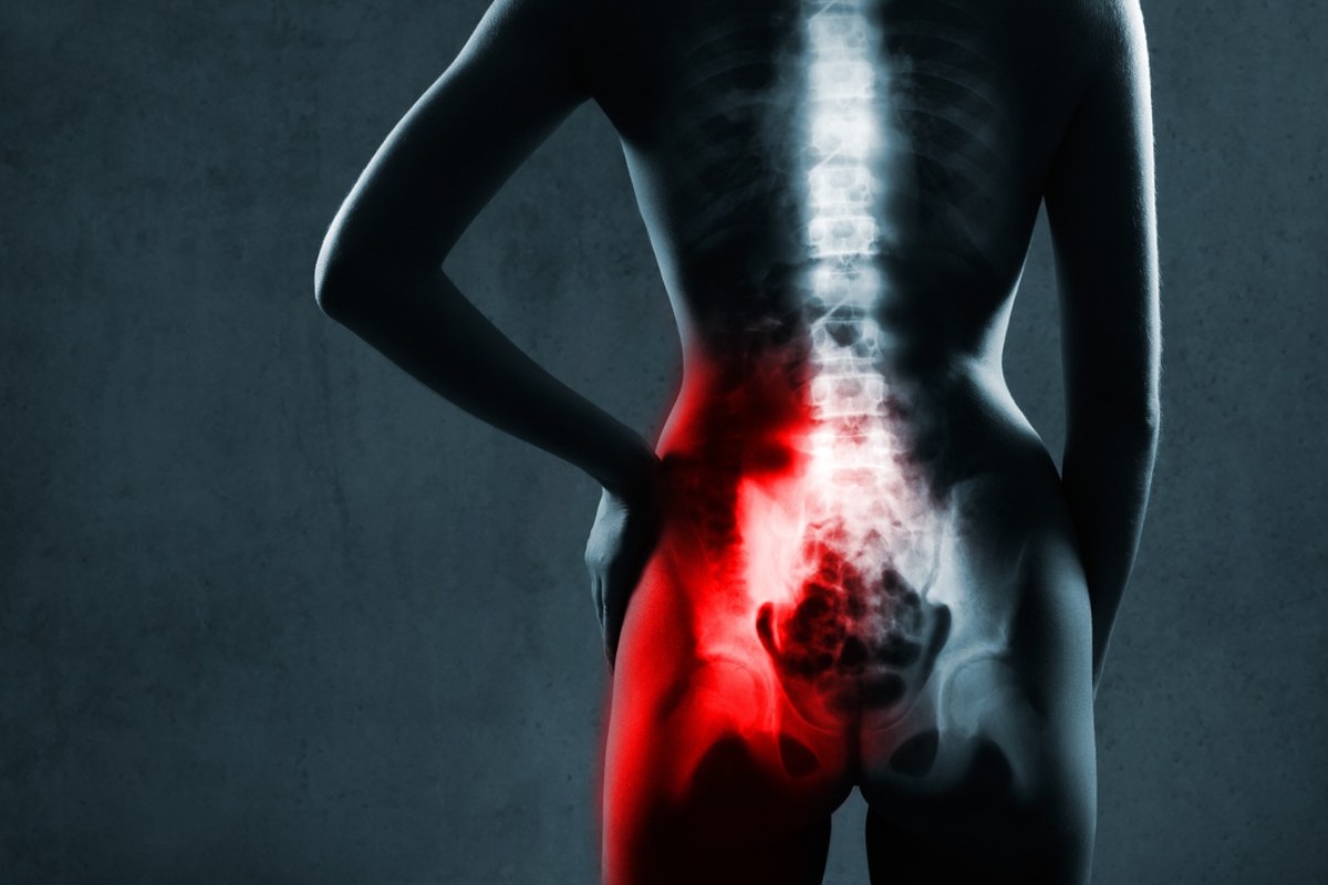 اختلال مفصل ساکروایلیاک