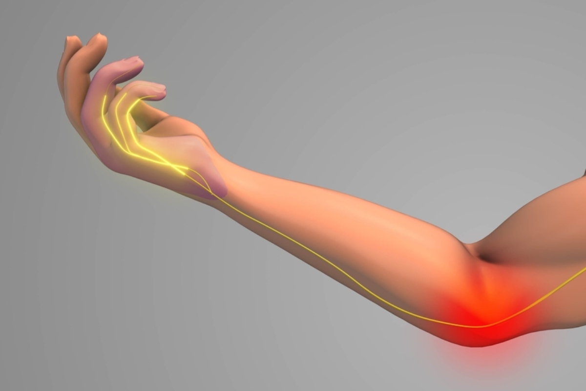 بیماری بورسیت