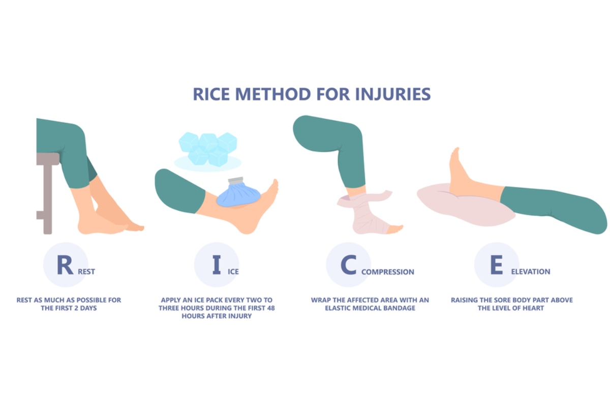 تکنیک RICE برای درمان کشیدگی تاندون مچ پا