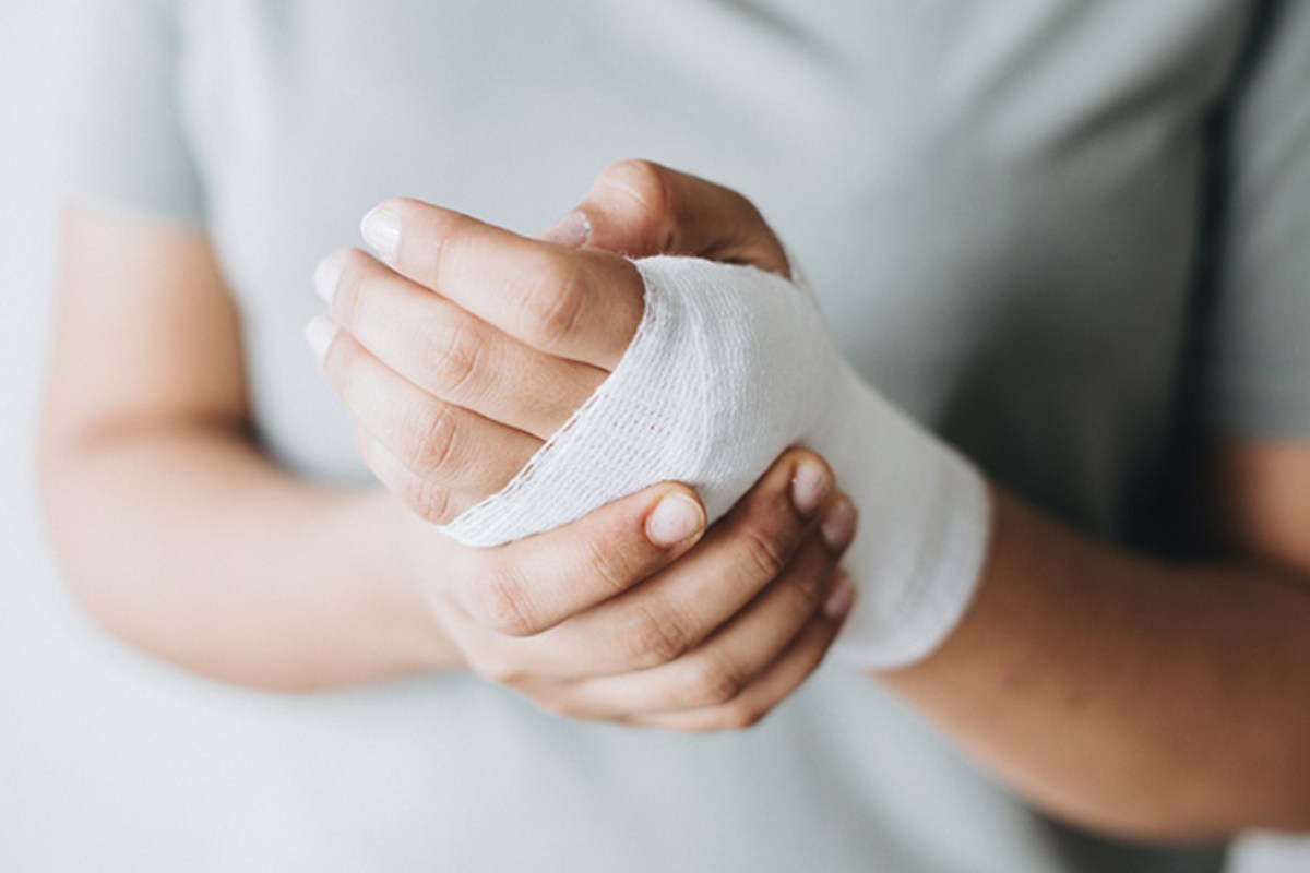 مراقبت و توانبخشی پس از درمان پارگی تاندون دست