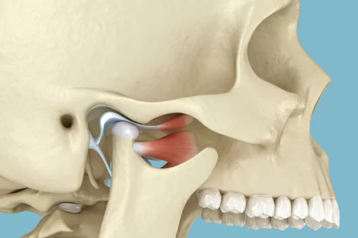 مفصل گیجگاهی فکی چیست