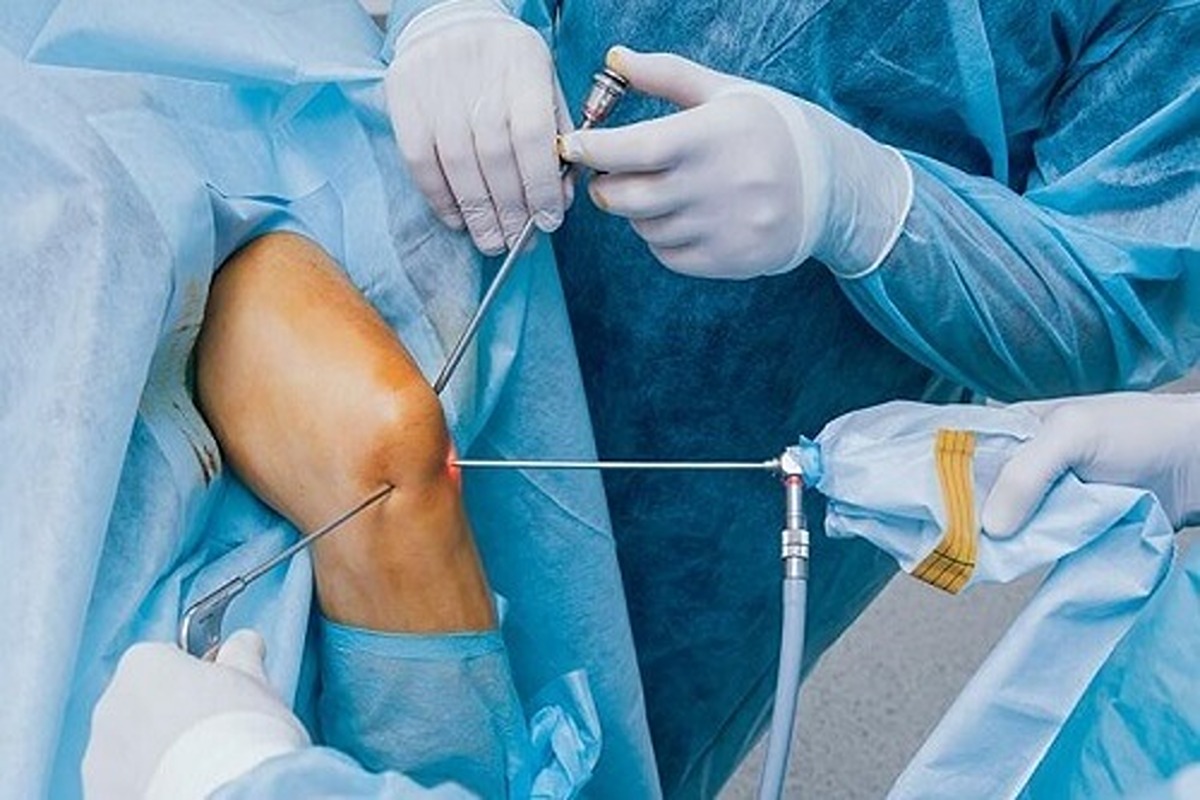 استفاده از جراحی برای درمان آسیب زانو