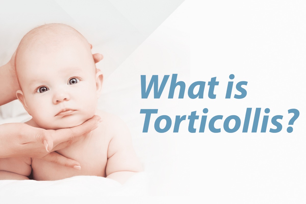 تورتیکولی چیست