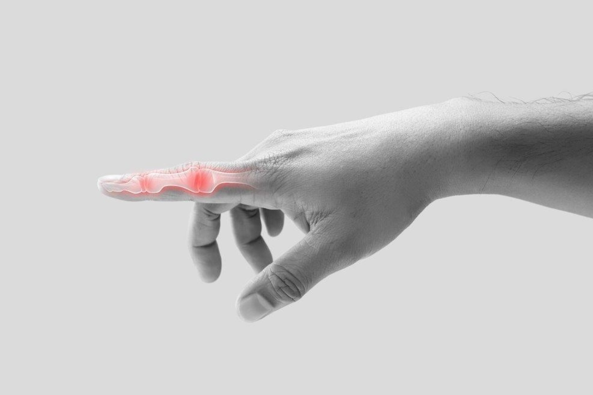 علائم کشیدگی تاندون انگشت دست