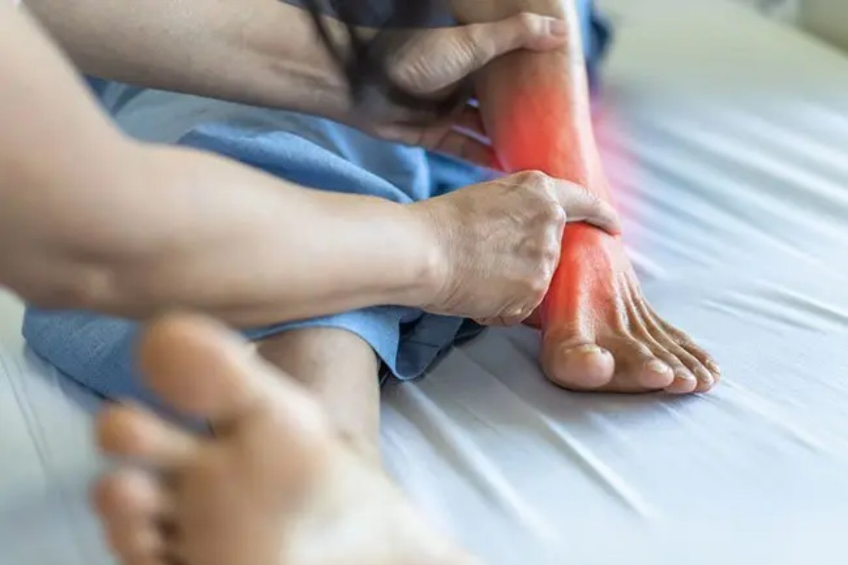 چه زمانی باید برای تاندونیت به پزشک مراجعه شود