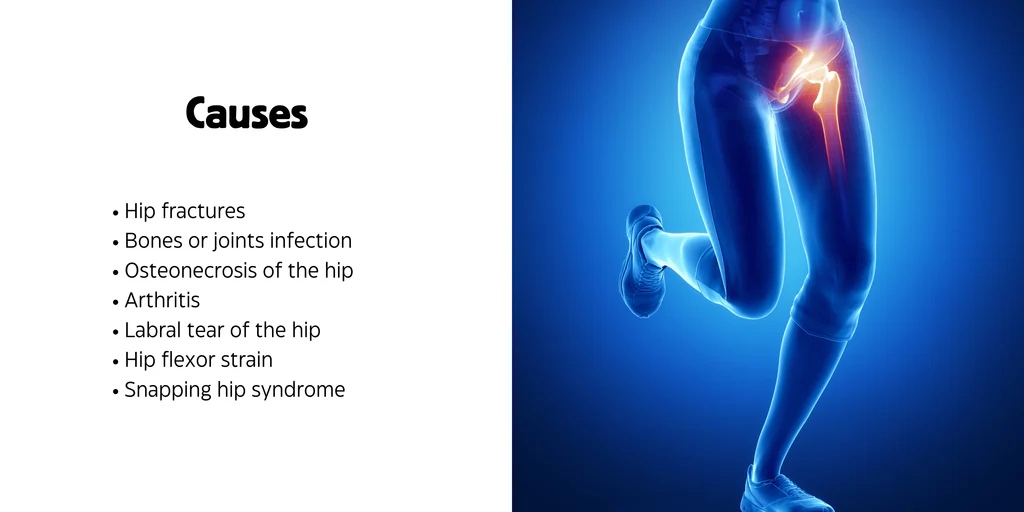 علت صدا دادن مفصل ران و لگن