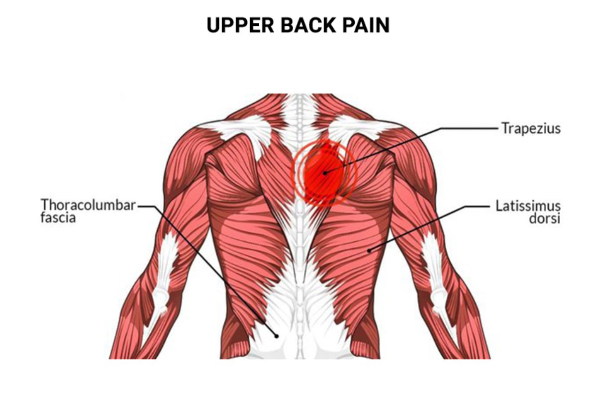 علت درد بالای کمر